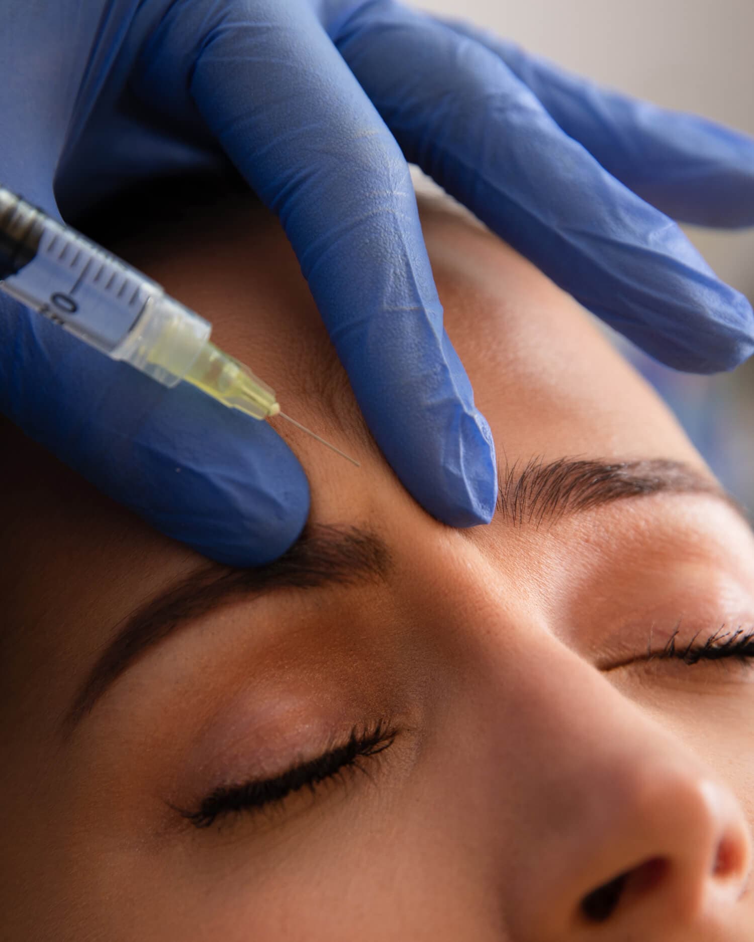 BOTOX-Treatment_1500x1875